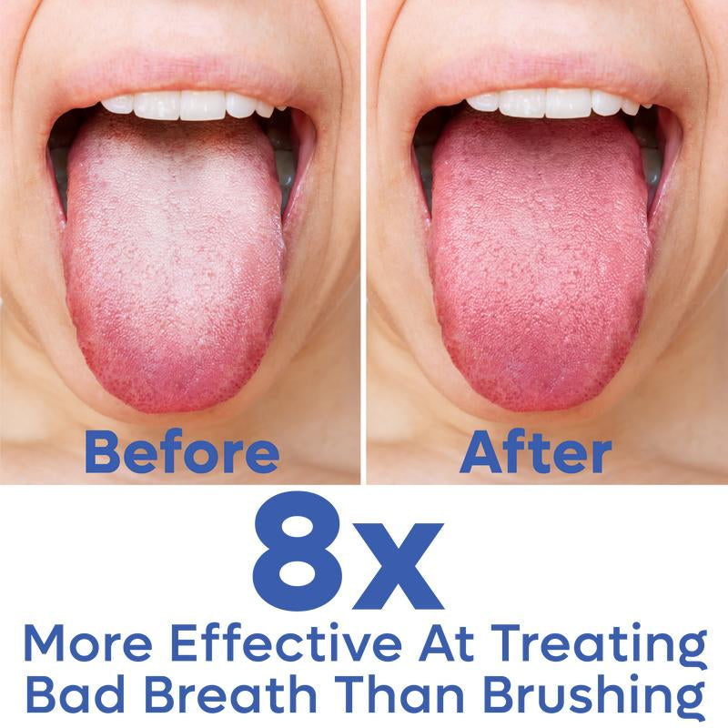 Stainless Steel Tongue Scraper – Dual-Scrape Tongue Cleaner, Fast & Effective for Fresher Breath, Travel-Friendly, Eco-Friendly with Metal Case - 2Pk